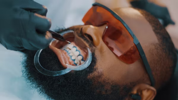 Teeth Whitening